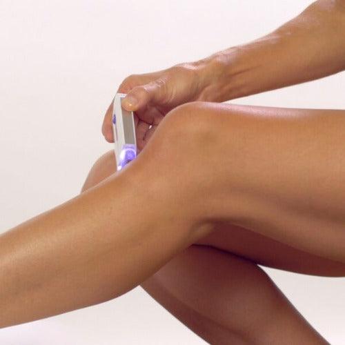 3 u 1 Odstranjivac dlacica