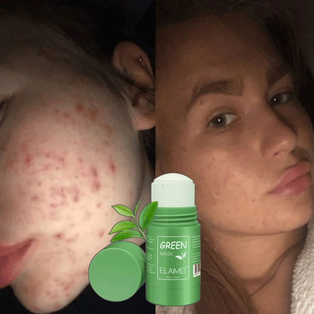 Green stick - Maska za lice 2+1 Gratis